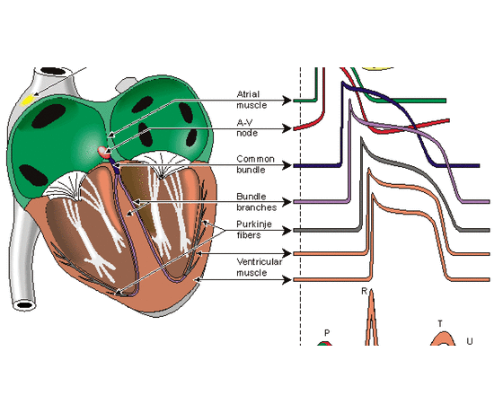 添翼2017-2018年ISPN/RN專業(yè)課56章&nbsp;心血管系統(tǒng)