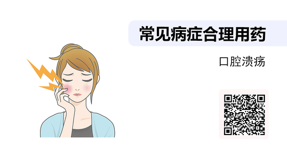 藥店常見病癥合理用藥（10）-口腔潰瘍