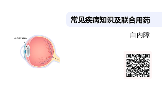 常見疾病知識及聯(lián)合用藥之-白內(nèi)障